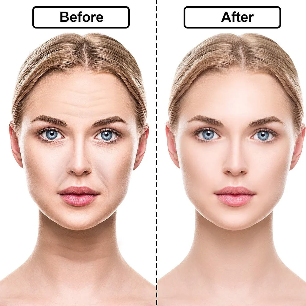 Women Reusable Silicone Wrinkle Removal Sticker Face Forehead Neck Eye Sticker Pad Anti Wrinkle Aging Skin Lifting Care Patch