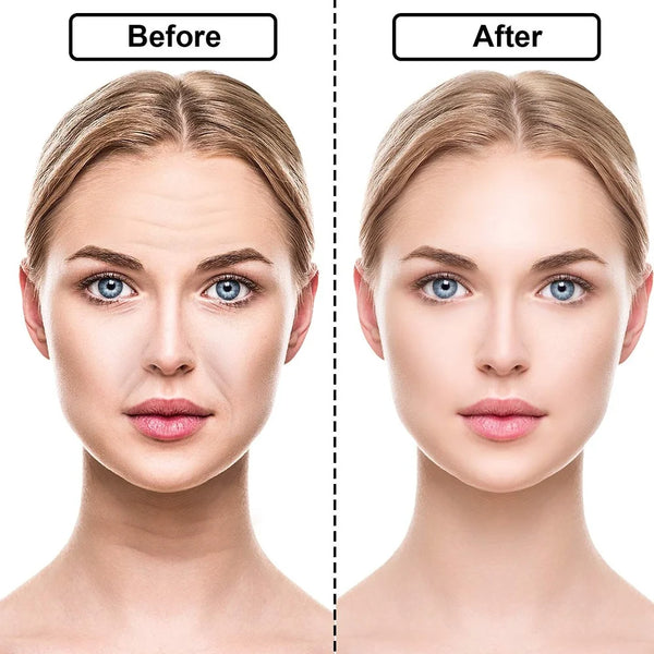 Women Reusable Silicone Wrinkle Removal Sticker Face Forehead Neck Eye Sticker Pad Anti Wrinkle Aging Skin Lifting Care Patch